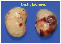 Cystic kindeys from Bhd-Ksp-cre mice